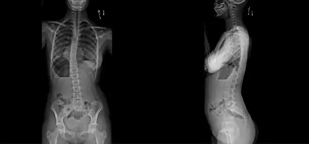 Cincinnati Children’s First Hospital In OH To Use Low Dose Imaging System