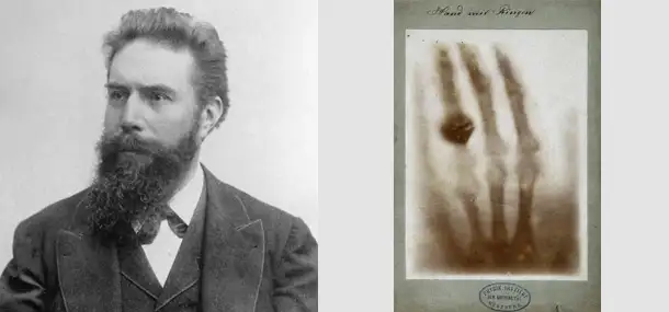 Radiology Through the Years