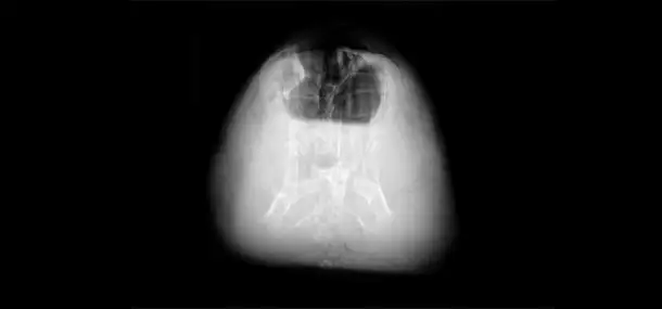 After image