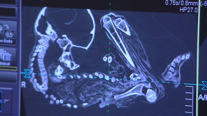 Radiology Reveals Results of #MummyScan