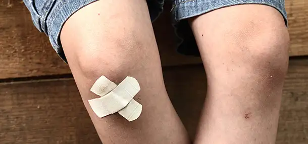 ACL Tear
