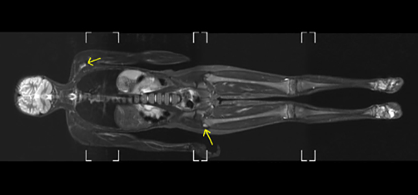 Whole-Body Imaging: From Head to Toe
