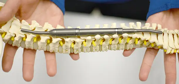 There’s MAGEC going on in Ultrasound