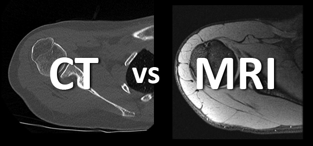 What’s the difference between an MRI and CT?