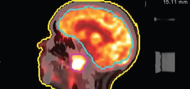 What’s New in Nuclear Medicine?