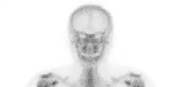 Something Spooky’s Going On in Radiology…