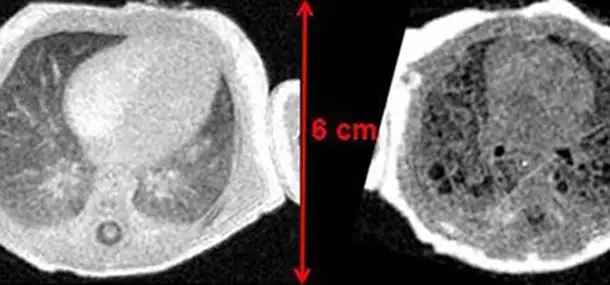 Dr. Jason Woods Takes Huge Strides in Imaging Lungs