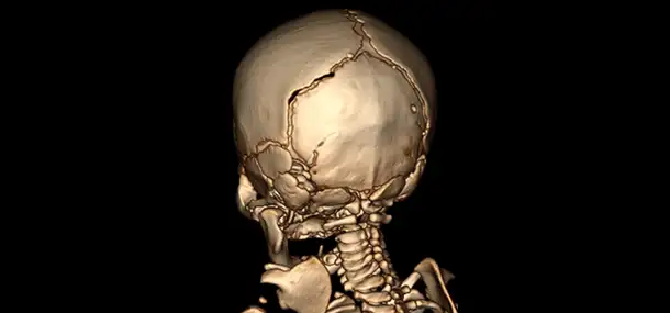 Early Imaging Signs of Traumatic Injuries and Spinal Cord Damage