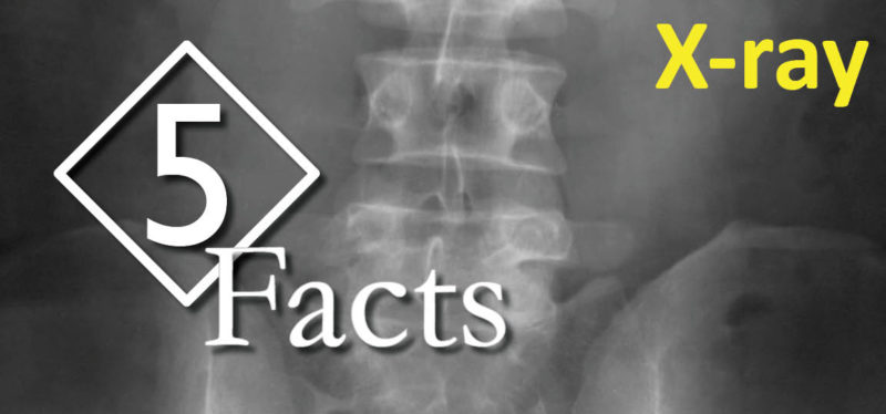 5 Facts: X-ray