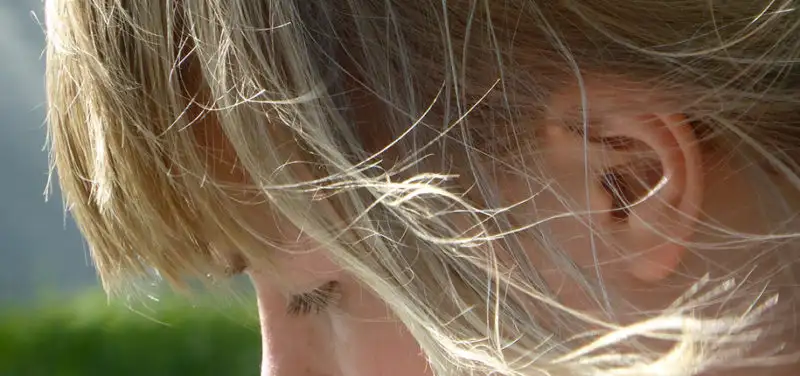 Imaging for Children with Sensorineural Hearing Loss