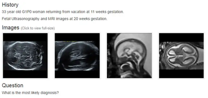 Case of the Day Online Learning System Reaches Radiologists Worldwide
