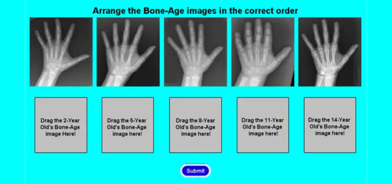 Using X-Rays To Evaluate Growth