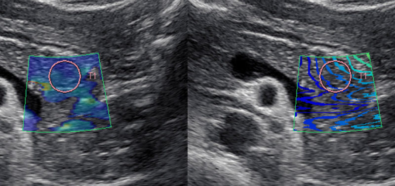 Cincinnati Children’s Excels in Ultrasound Imaging