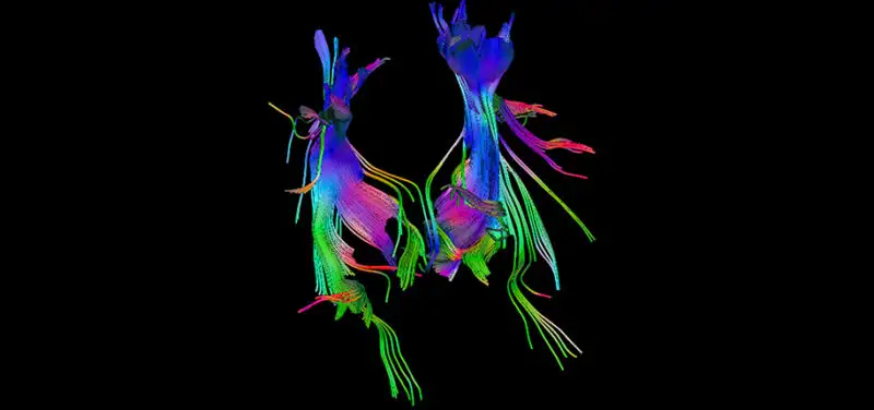 What Is Functional MRI? Our Expert Explains