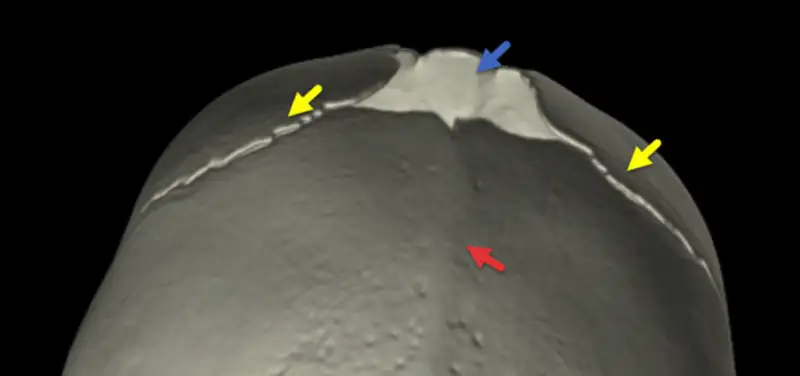 My child’s head is asymmetric!