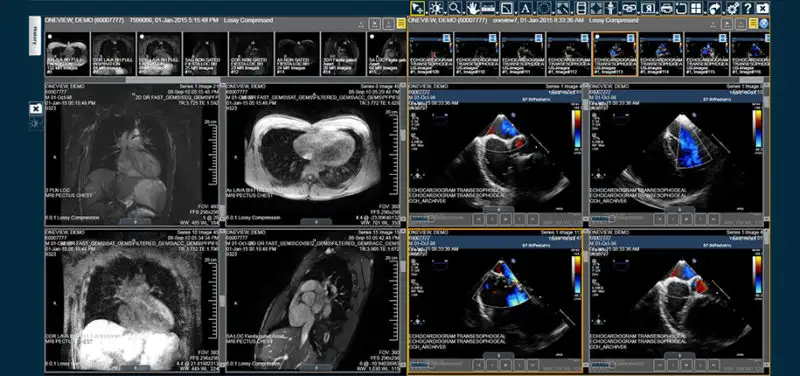 OneView: An Evolution in Medical Technology for the Better