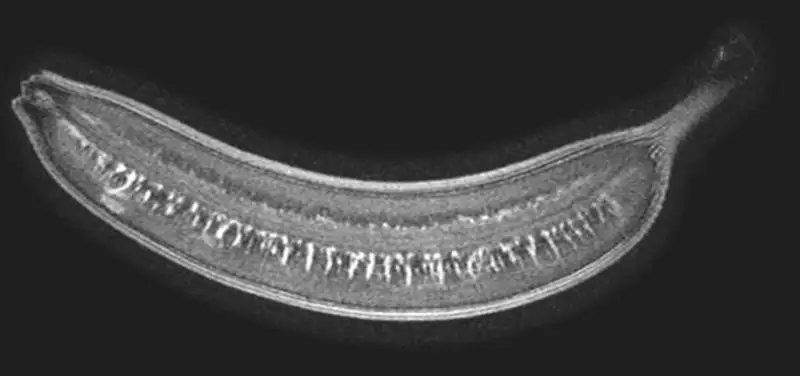 Today is Banana Day!