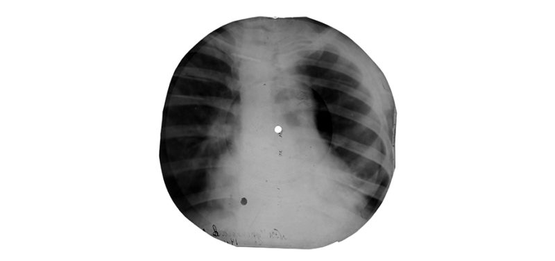 Bone Music: How X-Rays and Records Crossed Paths