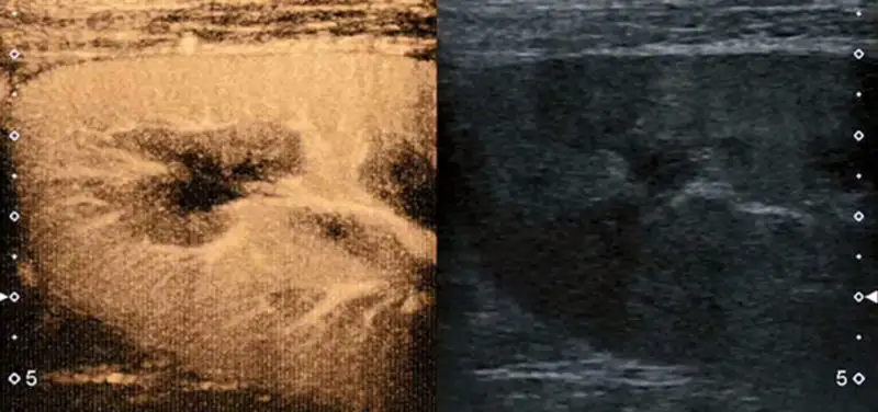 Bubbles… Bubbles…POP!