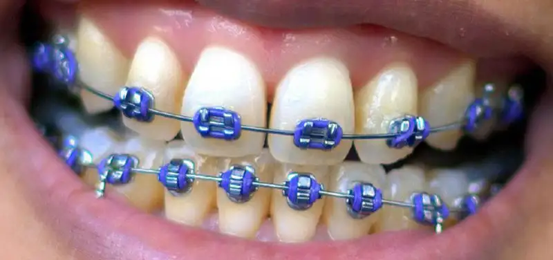 Cincinnati Children’s Radiology Blog Reaches Milestone 