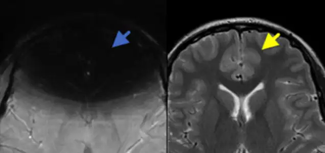 MRI Safety Quiz