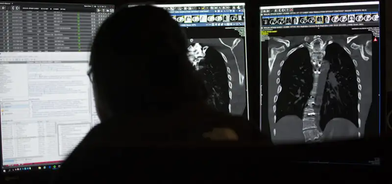 The Tale of the WOPR and the Pediatric Radiologist