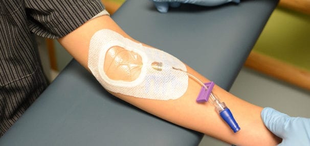 Making Intravenous Access Safer for Our Patients - Radiating Hope