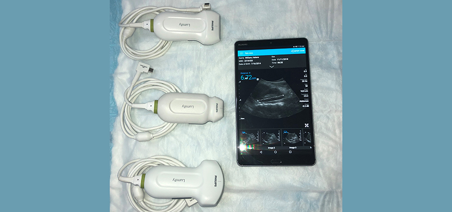 Pediatric Ultrasound is Now “Pocket-Sized”