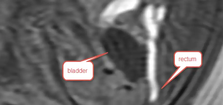 Collaboration with Other Doctors and Healthcare Teams in Fetal Imaging Diagnosis