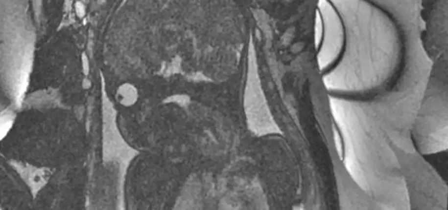 Why does my fetal MRI take so long?