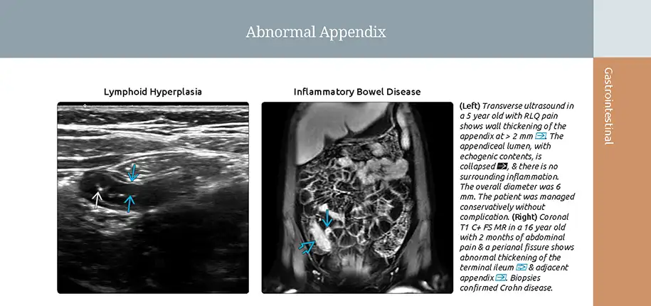 A Guide for Radiologists to the Right Diagnosis of Your Child’s Illness