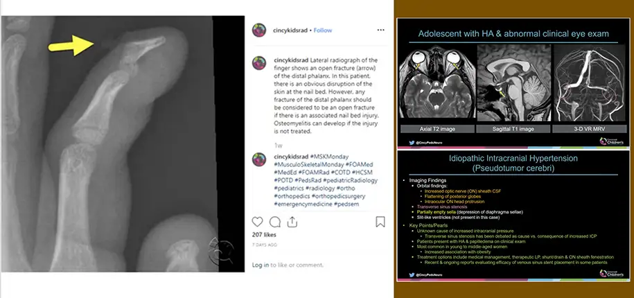 Sharing the Wealth through Social Media