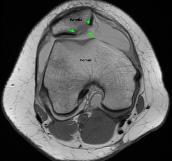 Ouch, My Knee Popped Out! - Radiating Hope