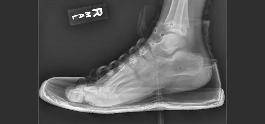 If the shoe fits, wear it