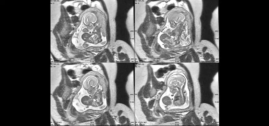 The Past, the Present and the Future of Fetal Imaging