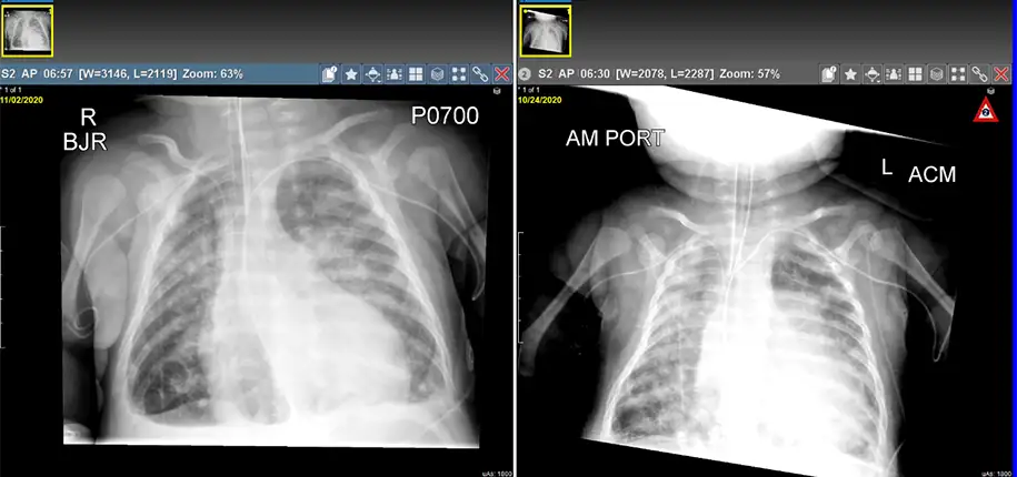 Where is the “Diagnosis Room”?  A Alimpse into Radiology NICU Rounds