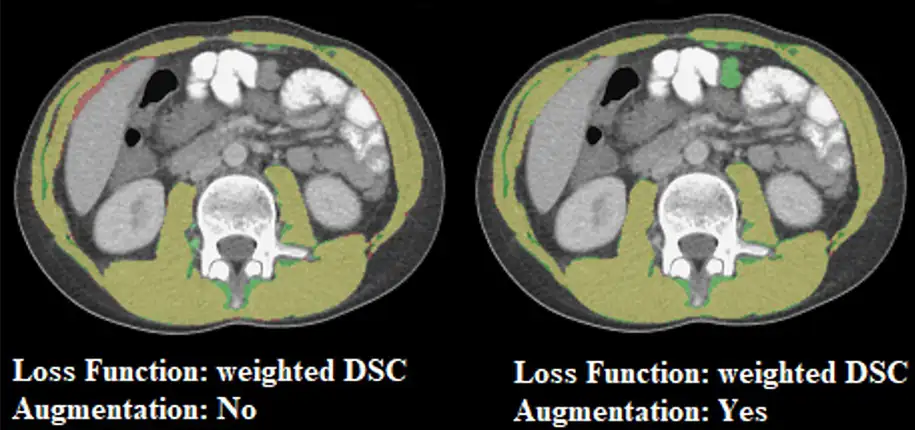 Artificial Intelligence Can Improve Child Care On Multiple Fronts 