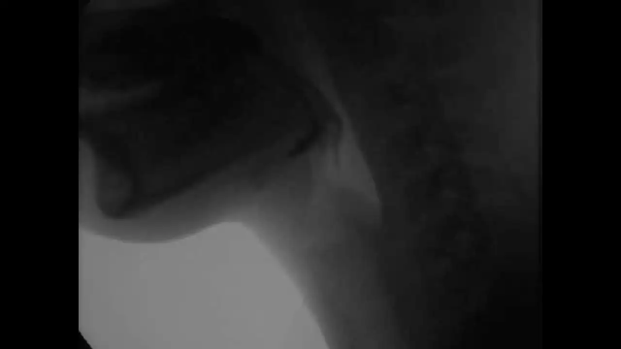 All about Fluoroscopy