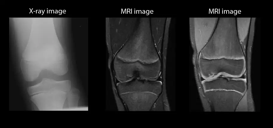 The Right Exam for the Right Diagnosis