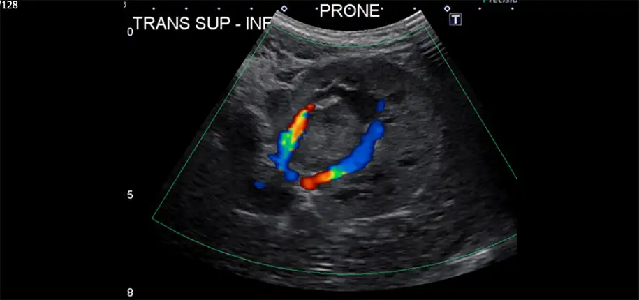 I Just Finished My Ultrasound Exam, Now What?