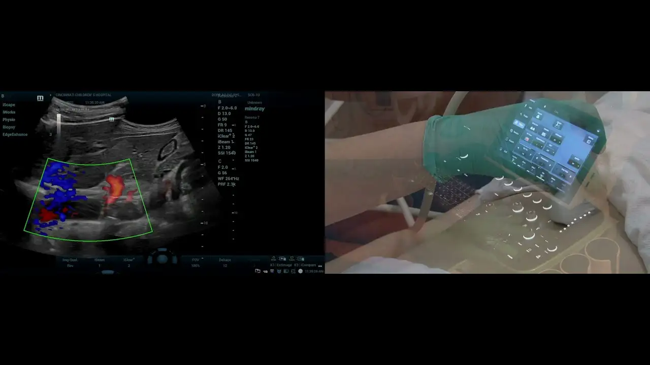 Using Ultrasound Heel Toe Technique