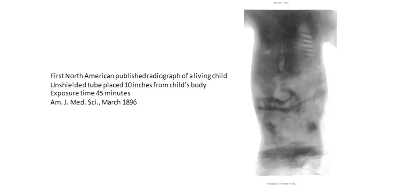 Celebrating National Radiology Week 2022 