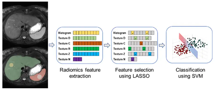 <strong>Prediction of Fontan Outcomes Using T2-Weighted MRI Radiomic Features and Machine Learning</strong> 
