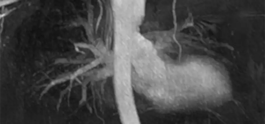 Imaging Blood Vessels