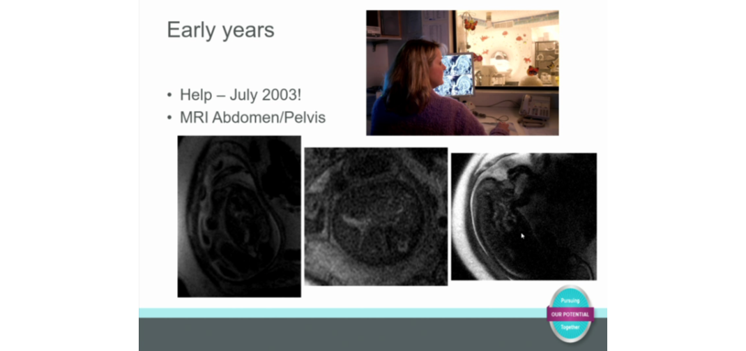 Fetal Imaging in Radiology, Then and Now 